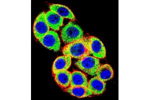 Confocal immunofluorescent analysis of PRKCA Antibody (N-term) (ABIN652517 and ABIN2842346) with Hela cell followed by Alexa Fluor 488-conjugated goat anti-rabbit lgG (green). (PKC alpha 抗体  (N-Term))