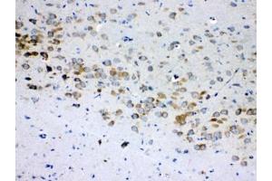 IHC testing of FFPE rat brain tissue with RPS6 antibody at 1ug/ml. (RPS6 抗体  (AA 13-52))