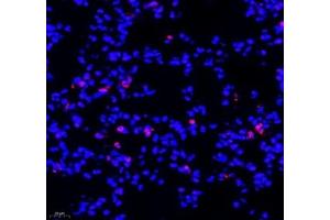 Immunofluorescence of paraffin embedded mouse lung using SIX1 (ABIN7075617) at dilution of 1: 650 (400x lens) (SIX Homeobox 1 抗体)