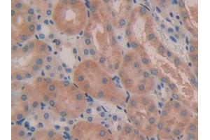 IHC-P analysis of Mouse Kidney Tissue, with DAB staining. (IL5RA 抗体  (AA 41-203))