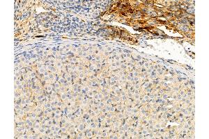 ABIN6266239 and ABIN6277380 at 1/100 staining Rat ovary tissue by IHC-P.