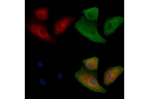 ABIN6262721 and ABIN6278917 staining  cells by IF/ICC. (KRT32 抗体  (Internal Region))