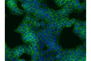 Immunocytochemistry staining of beta-catenin in humancolon adenocarcinoma cell line HT29 using EM-22 antibody (green). (beta Catenin 抗体)