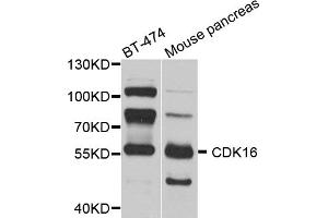 Western blot analysis of extracts of various cell lines, using CDK16 antibody. (CDK16 抗体)