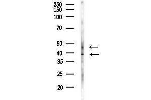 Western blot analysis of lysates from Rat brain, using C Antibody at 1/1000 dilution.