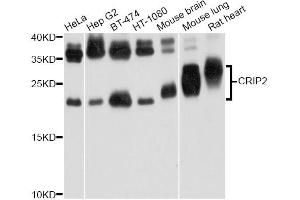 Western blot analysis of extracts of various cell lines, using CRIP2 Antibody. (CRIP2 抗体)