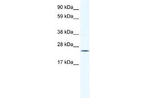 WB Suggested Anti-KCTD6 Antibody Titration:  0. (KCTD6 抗体  (N-Term))
