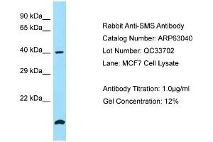 Western Blotting (WB) image for anti-Spermine Synthase, SMS (SMS) (N-Term) antibody (ABIN2789345) (SMS 抗体  (N-Term))