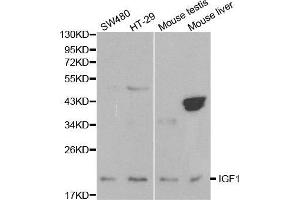 Western blot analysis of extracts of various cell lines, using IGF1 antibody.