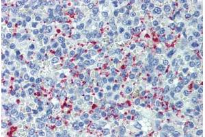 Human Spleen (formalin-fixed, paraffin-embedded) stained with SELP antibody ABIN462342 followed by biotinylated anti-mouse IgG secondary antibody ABIN481714, alkaline phosphatase-streptavidin and chromogen. (P-Selectin 抗体)