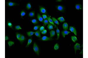 Immunofluorescence staining of A549 cells with ABIN7156159 at 1:100, counter-stained with DAPI. (PLCL1 抗体  (AA 1-108))