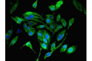 Immunofluorescent analysis of Hela cells using ABIN7142365 at dilution of 1:100 and Alexa Fluor 488-congugated AffiniPure Goat Anti-Rabbit IgG(H+L) (MRPL19 抗体  (AA 1-292))