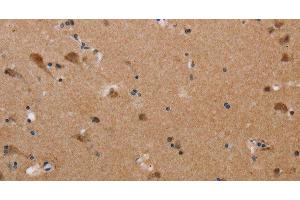 Immunohistochemistry of paraffin-embedded Human brain tissue using PLXNA4 Polyclonal Antibody at dilution 1:50 (Plexin A4 抗体)