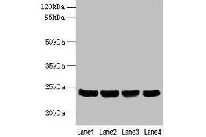 Western blot All lanes: EMC8 antibody at 4 μg/mL Lane 1: A549 whole cell lysate Lane 2: Human placenta tissue Lane 3: Hela whole cell lysate Lane 4: HT29 whole cell lysate Secondary Goat polyclonal to rabbit IgG at 1/10000 dilution Predicted band size: 24, 14 kDa Observed band size: 24 kDa (COX4NB 抗体  (AA 1-210))