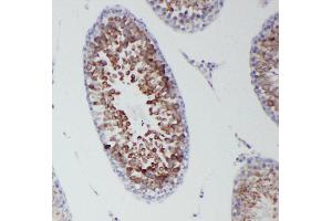 Anti-DDX4/MVH antibody, IHC(P) IHC(P): Rat Testis Tissue (DDX4 抗体  (Middle Region))