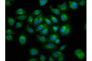 Immunofluorescence staining of A549 cells with ABIN7165321 at 1:100, counter-stained with DAPI. (LMAN1 抗体  (AA 154-329))