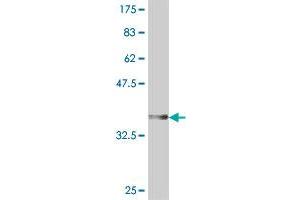 Western Blot detection against Immunogen (37 KDa) . (DPYSL4 抗体  (AA 461-559))