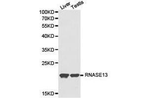 Western Blotting (WB) image for anti-Ribonuclease, RNase A Family, 13 (Non-Active) (RNASE13) antibody (ABIN1874615) (RNASE13 抗体)