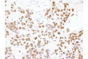 anti-Heterogeneous Nuclear Ribonucleoprotein L (HNRNPL) (C-Term) antibody