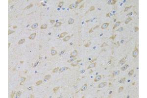 Immunohistochemistry (Paraffin-embedded Sections) (IHC (p)) image for anti-Glycyl-tRNA Synthetase (GARS) (AA 60-370) antibody (ABIN6140964)