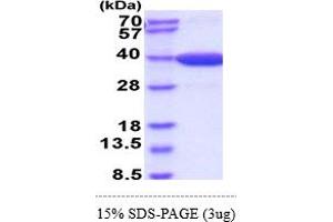 MDH2 Protein (AA 25-338) (His tag)