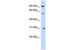 Image no. 1 for anti-Mannosyl (Alpha-1,6-)-Glycoprotein beta-1,2-N-Acetylglucosaminyltransferase (MGAT2) (AA 251-300) antibody (ABIN6743326) (MGAT2 抗体  (AA 251-300))