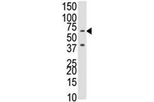 Western Blotting (WB) image for anti-Bone Morphogenetic Protein Receptor, Type IB (BMPR1B) (AA 1-30) antibody (ABIN3030190)