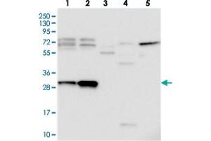Western blot analysis of Lane 1: RT-4, Lane 2: U-251 MG, Lane 3: Human Plasma, Lane 4: Liver, Lane 5: Tonsil with C15orf23 polyclonal antibody  at 1:250-1:500 dilution. (KNSTRN 抗体)