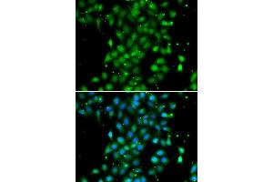 Immunofluorescence analysis of MCF7 cell using UBE2Z antibody. (UBE2Z 抗体)