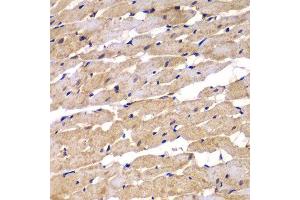 Immunohistochemistry of paraffin-embedded rat heart using PSEN2 antibody. (Presenilin 2 抗体)