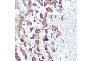 Immunohistochemistry of paraffin-embedded human liver using [KO Validated] NDUFB4 Rabbit pAb (ABIN6133349, ABIN6144476, ABIN6144477 and ABIN7101430) at dilution of 1:150 (40x lens).