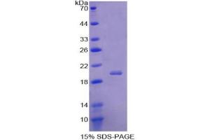 SDS-PAGE analysis of Human Acid Phosphatase 1 Protein. (ACP1 蛋白)