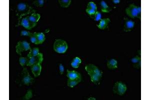 Immunofluorescent analysis of MCF-7 cells using ABIN7171522 at dilution of 1:100 and Alexa Fluor 488-congugated AffiniPure Goat Anti-Rabbit IgG(H+L) (GBL 抗体  (AA 159-220))