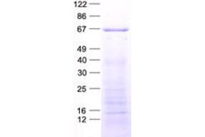 Western Blotting (WB) image for phosphoinositide Kinase, FYVE Finger Containing (PIKFYVE) protein (His tag) (ABIN2729013)