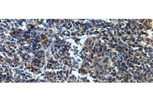 Immunohistochemistry of paraffin-embedded Human tonsil tissue using ATP1B2 Polyclonal Antibody at dilution of 1:25(x200) (ATP1B2 抗体)