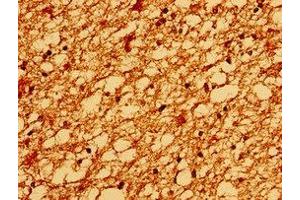 Immunohistochemistry of paraffin-embedded human brain tissue using ABIN7172938 at dilution of 1:100 (TM6SF2 抗体  (AA 290-331))