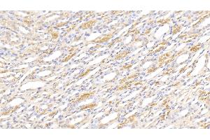 Detection of HB in Canine Kidney Tissue using Polyclonal Antibody to Hemoglobin (HB) (Hemoglobin 抗体)