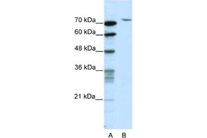 Western Blotting (WB) image for anti-TAF6 RNA Polymerase II, TATA Box Binding Protein (TBP)-Associated Factor, 80kDa (TAF6) antibody (ABIN2461761) (TAF6 抗体)