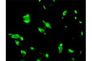 Immunofluorescence staining of human LNCaP cell colony with STEAP1 monoclonal antibody, clone J2D2 . (STEAP1 抗体  (AA 1-70))