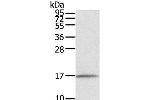Western Blot analysis of Human normal liver tissue using EVA1A Polyclonal Antibody at dilution of 1:550 (TMEM166 抗体)