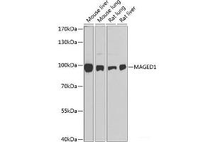 Western blot analysis of extracts of various cell lines using MAGED1 Polyclonal Antibody at dilution of 1:1000. (MAGED1 抗体)
