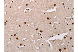 The image on the left is immunohistochemistry of paraffin-embedded Human brain tissue using ABIN7128323(AKAP8L Antibody) at dilution 1/20, on the right is treated with fusion protein. (AKAP8L 抗体)