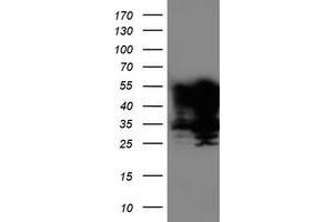 Western Blotting (WB) image for anti-T-Cell Acute Lymphocytic Leukemia 1 (TAL1) antibody (ABIN1501291)