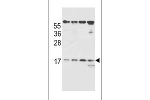 TCRB Antibody (Center) (ABIN656127 and ABIN2845468) western blot analysis in MDA-M,HE,Ramos,NCI- cell line lysates (35 μg/lane).