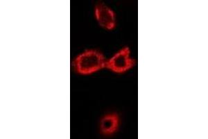 Immunofluorescence (IF) image for anti-Solute Carrier Family 7 (Cationic Amino Acid Transporter, Y+ System), Member 1 (SLC7A1) antibody (ABIN7306564)