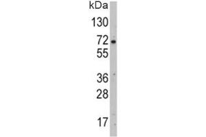 Western blot analysis of GLUT2 antibody and HepG2 lysate. (SLC2A2 抗体  (AA 31-60))