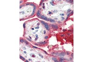 Formalin-fixed and paraffin-embedded human Placenta tissue reacted with OA1 antibody (N-term) 7414a , which was peroxidase-conjugated to the secondary antibody, followed by AEC staining. (APOA1 抗体  (N-Term))