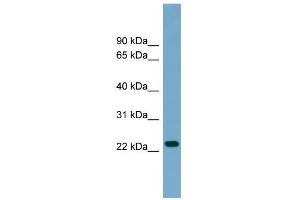 WB Suggested Anti-ARL8B Antibody Titration: 0. (ARL8B 抗体  (Middle Region))