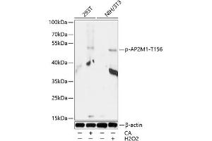 Western blot analysis of extracts of 293T and NIH/3T3 cells, using Phospho-M1-T156 antibody (ABIN7265449) at 1:1000 dilution. (AP2M1 抗体  (pThr156))
