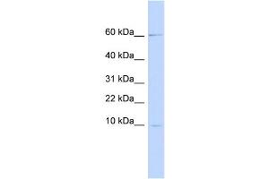 WB Suggested Anti-PI3 Antibody Titration:  0. (PI3 抗体  (Middle Region))